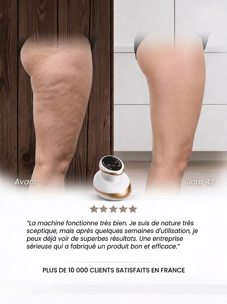 Masseur Anti-Cellulite Chauffant Dreliv